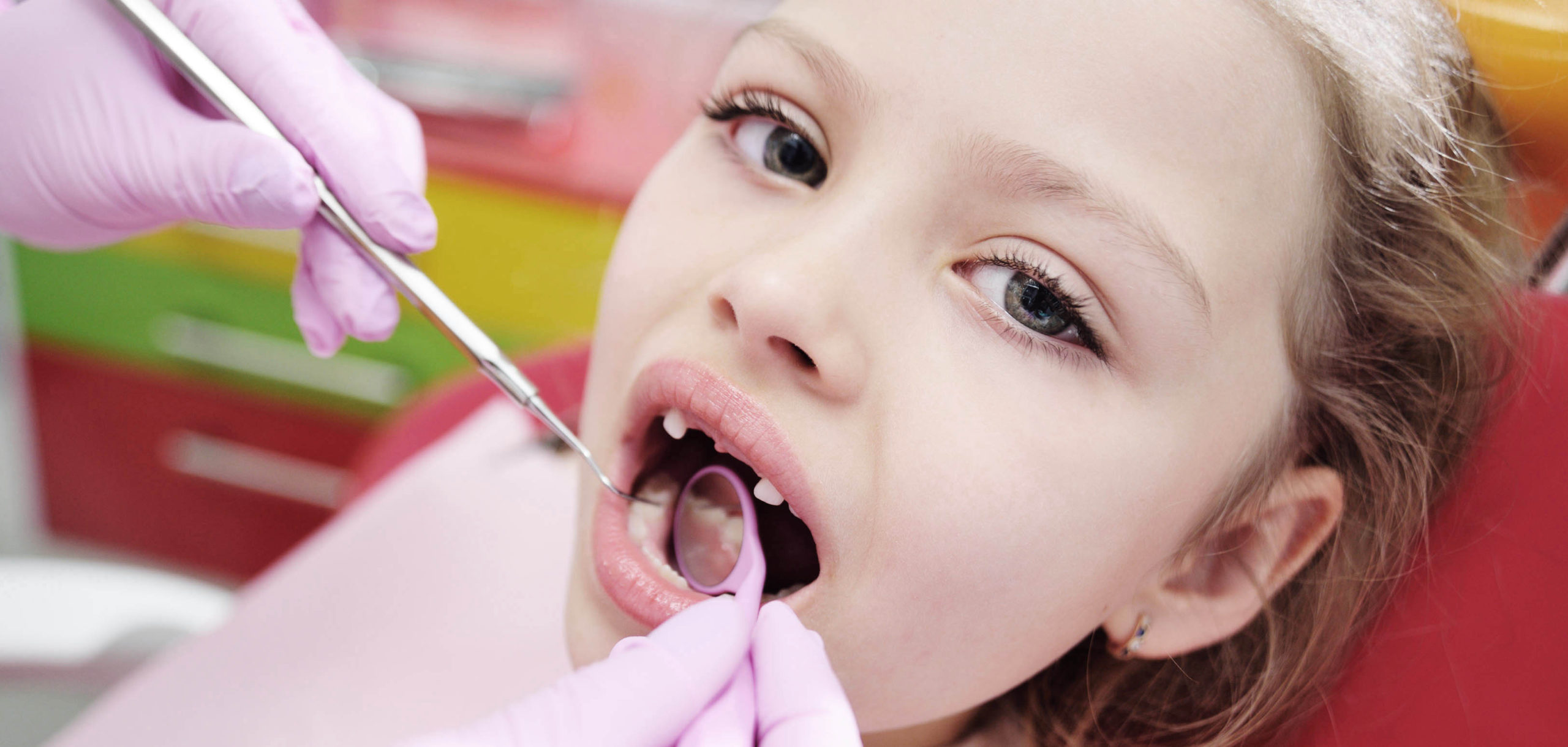 Ortodonzia infantile