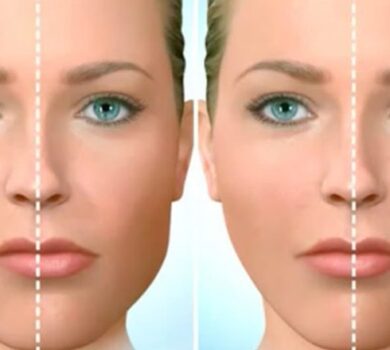 Studio Dentistico Lucaferri - Ortognatica