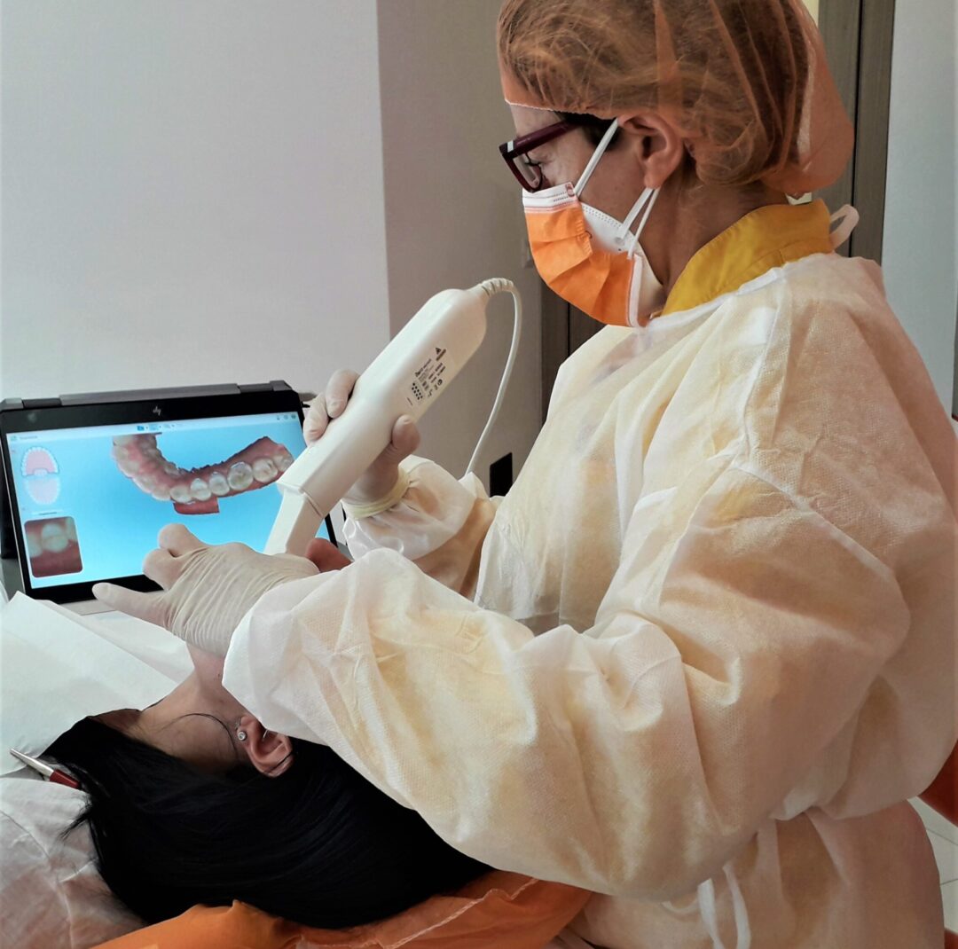Impronta Ottica Digitale:massimo Confort Per Il Paziente, In Tempo Reale Sono Visibili I Risultati Della Scanzione.