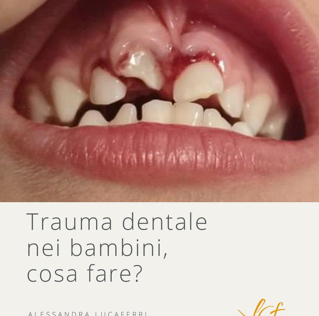 Trauma Dentale - Studio Dentistico Lucaferri