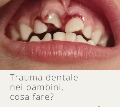 Trauma Dentale - Studio Dentistico Lucaferri