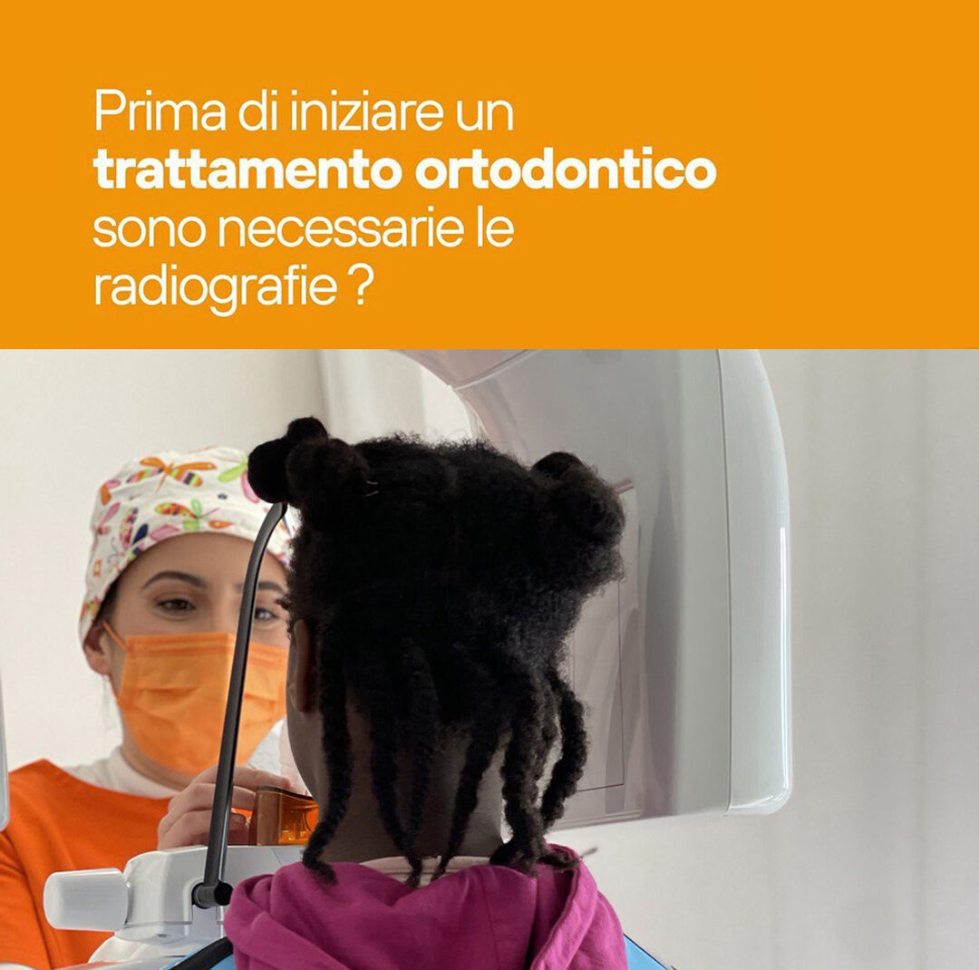 Ortodonzia Pediatrica - Studio Dentistico Lucaferri
