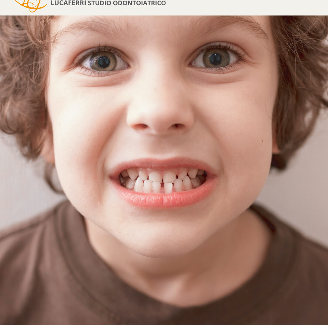 Morso Crociato - Studio Dentistico Lucaferri