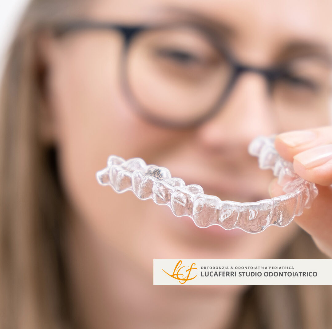 Allineatori - Studio Dentistico Lucaferri