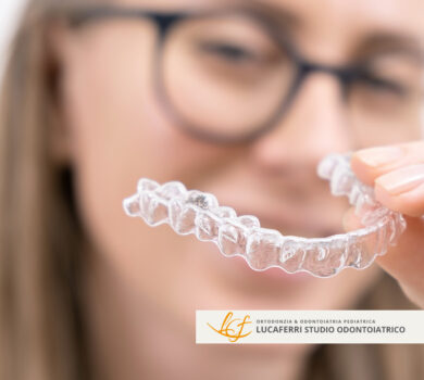 Allineatori - Studio Dentistico Lucaferri