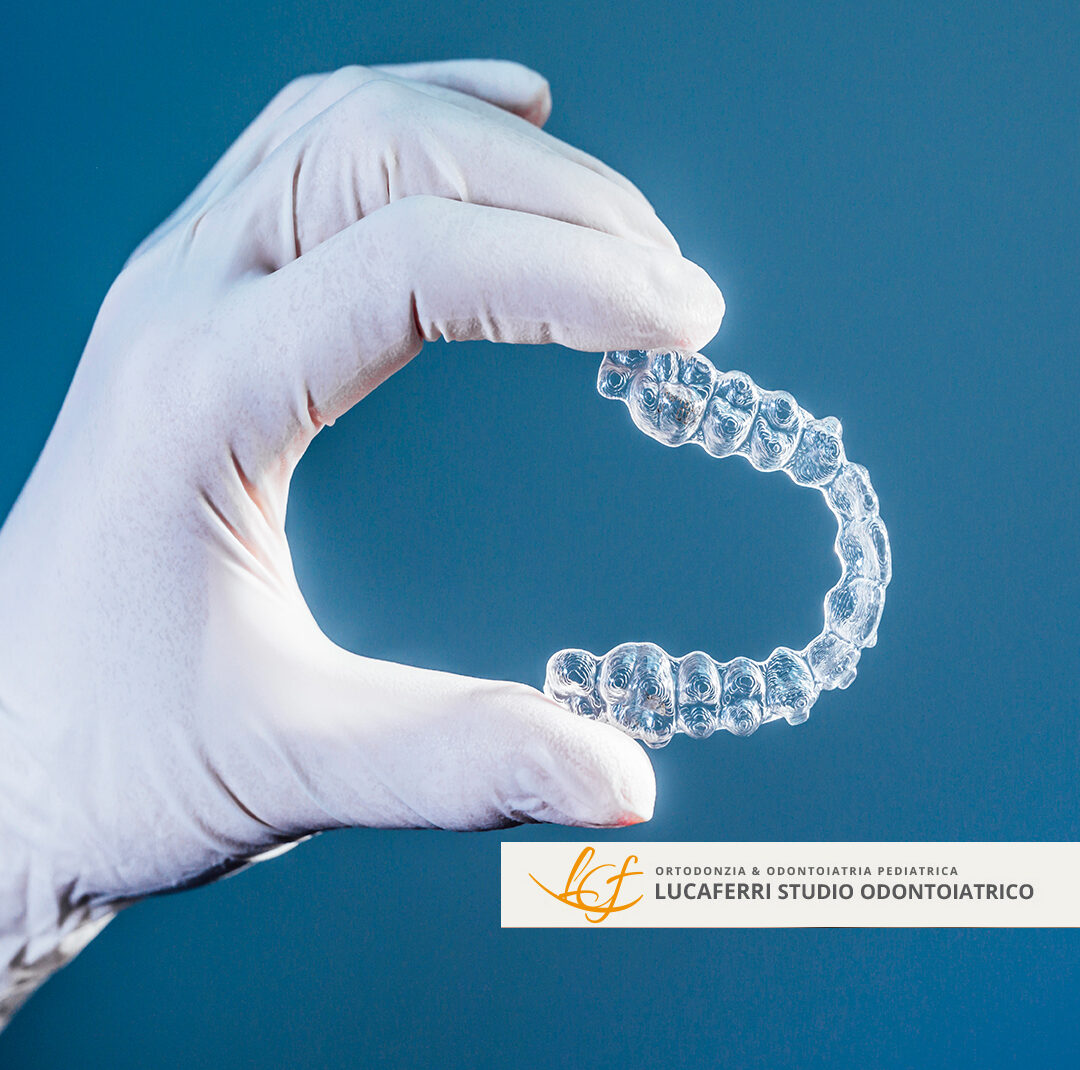 Allineatori Trasparenti - Studio Dentistico Lucaferri