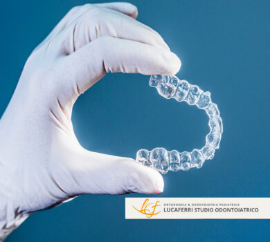 Allineatori Trasparenti - Studio Dentistico Lucaferri