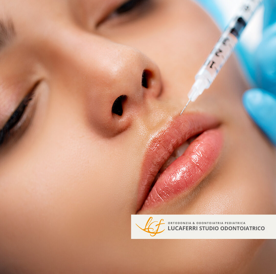 Filler - Studio Dentistico Lucaferri