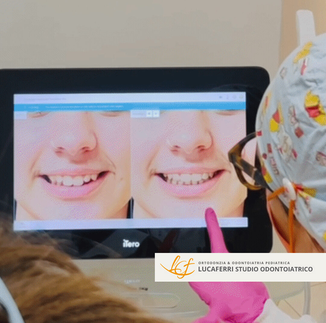 Ortodonzia Digitale - Studio Dentistico Lucaferri
