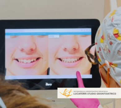 Ortodonzia Digitale - Studio Dentistico Lucaferri