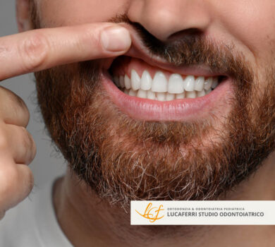 Ortodonzia - Studio Dentistico Lucaferri