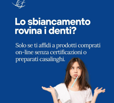 Sbiancamento Dentale - Studio Dentistico Lucaferri